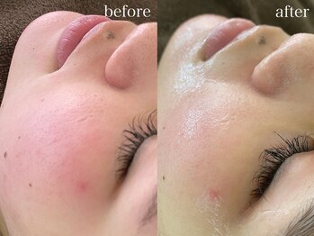 テオリア(TEORIA)/ツヤツヤモチモチ肌♪