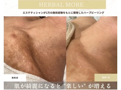 煌/ケースタイル(K-style)の写真