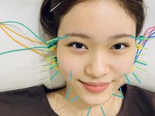 フラット(flat)の雰囲気（【電気を流す小顔美容鍼】小顔・むくみ/肌質改善・ニキビケア◎）