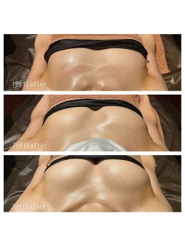 ネイト ワックス(Neit Wax)/３回のビフォーアフター♪