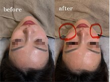 エネ ラッシュアンドブロウ バイ アンドエラ(ENNE Lash&Blow by&ERA)/小顔整体