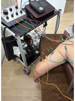 タカオカ接骨院 鍼灸院(TAKAOKA接骨院 鍼灸院)/全身鍼灸・慢性疲労３