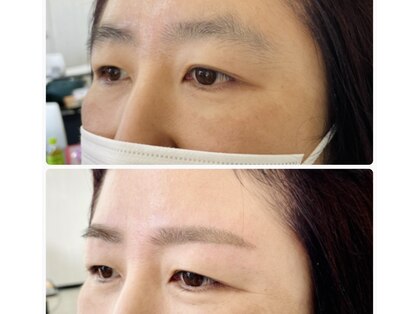 ベールス(Bellus)の写真