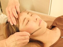 テンジンはり灸院(tenjinはり灸院)/抜鍼後は、しん美鍼の施術