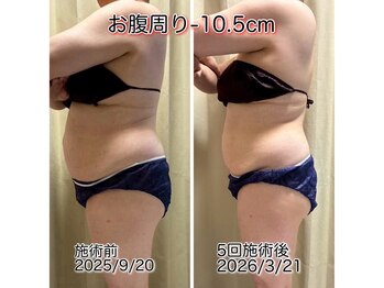 クールスパ(COOL SPA)/100CUPチャレンジ