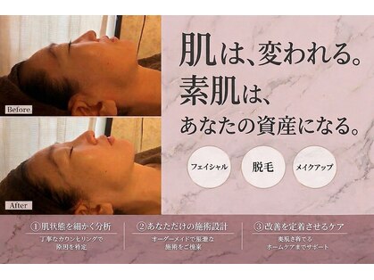 レイ(REI)の写真