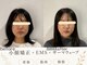 エスポワール(espoir)の写真