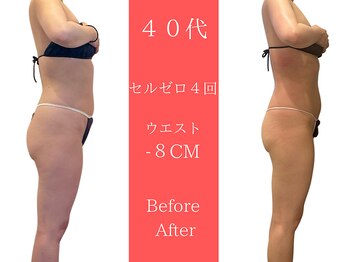 ムーン 高崎店(MOON)/2週間でこの変化
