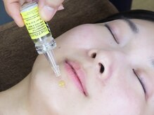 ひまわり鍼灸接骨院の雰囲気（整体/鍼灸/美容鍼/肩こり/骨盤矯正/マッサージ）