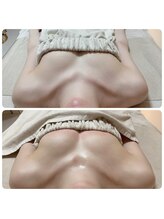 美人バスト リグラス(ReGrous)/バストアップbefore,after