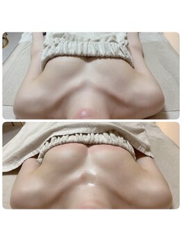 美人バスト リグラス(ReGrous)/バストアップbefore,after