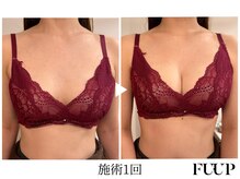 フーアップ 北千住(FU-UP)/バストアップ/育乳（1回）