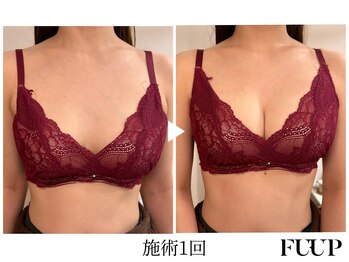 フーアップ 北千住(FU-UP)/バストアップ/育乳（1回）