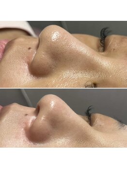 パッチ バイ サロンデヤンス(Patch by SALON DE YANSU)/