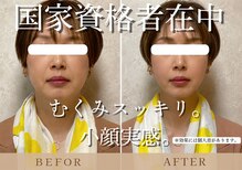 トトノイ 高知(TOTONOi)