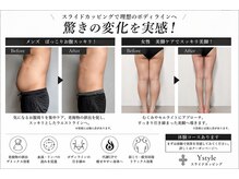 ワイスタイル(Ystyle)