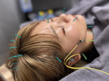 ラナスサッポロ(RUNUS SAPPORO)の写真/原因がわからない不調に施術！豊富な知識で自律神経の不調に寄り添うサロン☆