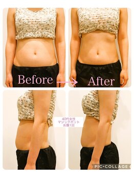 グレイティフル(Grateful)/1回　20分の施術でここまで