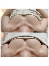 美人バスト リグラス(ReGrous)/バストアップbefore,after