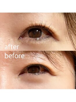 ミテ(mite)/まつパでリフトアップ