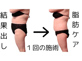 フロレゾン(Floraison)/絶対結果だしたい!