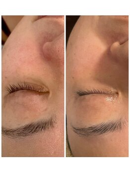 シュシュ(chouchou)/before after