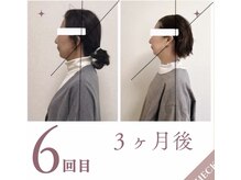 ラニ(Lani)/小顔美人整顔