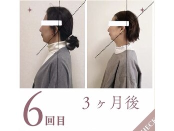 ラニ(Lani)/小顔美人整顔