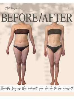 エイエービジュー(Aa.bijou)/