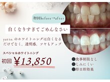 ヤット 森ノ宮(yatto.)/初回スペシャルホワイトニング