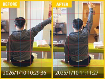整体院 元 宇城松橋店/右肩の痛みの悩み