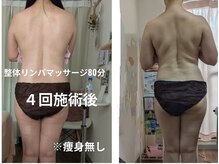 春日市でリンパマッサージが人気のサロン｜ホットペッパービューティー