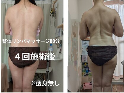 紬(TSUMUGI)の写真