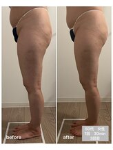 エムプラス(Mplus.)/話題のビジリス♪