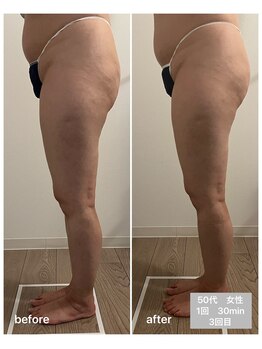 エムプラス(Mplus.)/話題のビジリス♪