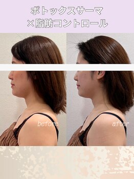 エン 橿原店(en)/メリハリのあり輪郭で若見え