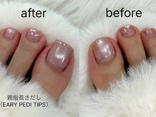 リノプラス(Lino+)/フットネイル　親指長さだし
