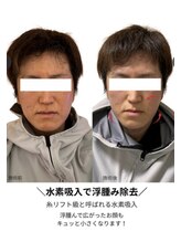 ヨサパーク メンソーレ(YOSA PARK)/男性も紹介で利用可能
