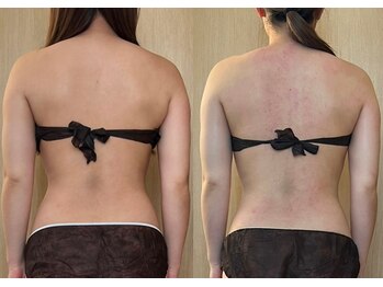 マイティー整骨院 ココア(CoCoa)/活性リンパ