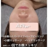 ユー(YU)