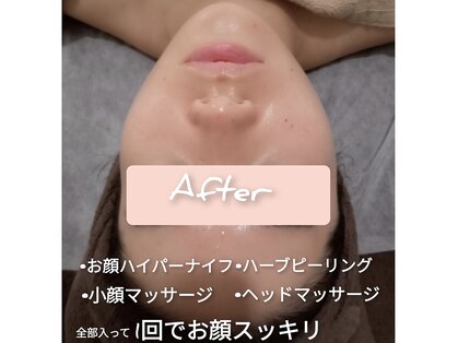 ユー(YU)の写真
