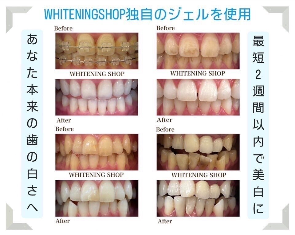 ホワイトニングショップ 八戸店｜ホットペッパービューティー
