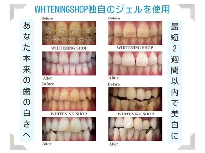 ホワイトニングショップ 八戸店の写真