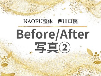 ナオル整体 西川口院(NAORU整体)/ 西川口 蕨 戸田 整体 骨盤矯正