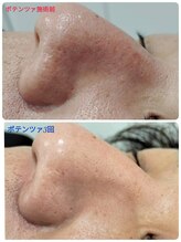 縁(en)/美容施術3回で激変☆