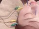 モッチ 天神大名店(MOCCHI)の写真/【速攻小顔◎】プロによる美容鍼でお顔・お肌のお悩みを解決！速攻性・持続性の高いシャープな小顔へ