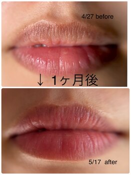 コルノ ラッシュアンドビヨンド(Corno Lash&beyond)/唇ローマピンク(20代)