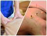 【基本施術（鍼＋整体）】50分