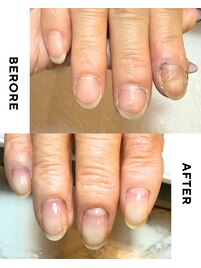 自爪育成☆爪は変われる