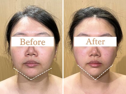 フローフシ∞の写真